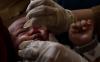 thumb-img