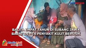 Balita Empat Tahun di Subang Jawa Barat Derita Penyakit Kulit Bersisik
