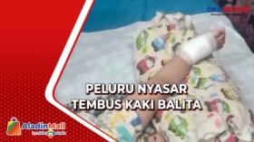 Heboh! Peluru Nyasar Tembus Kaki Balita di Bandar Lampung